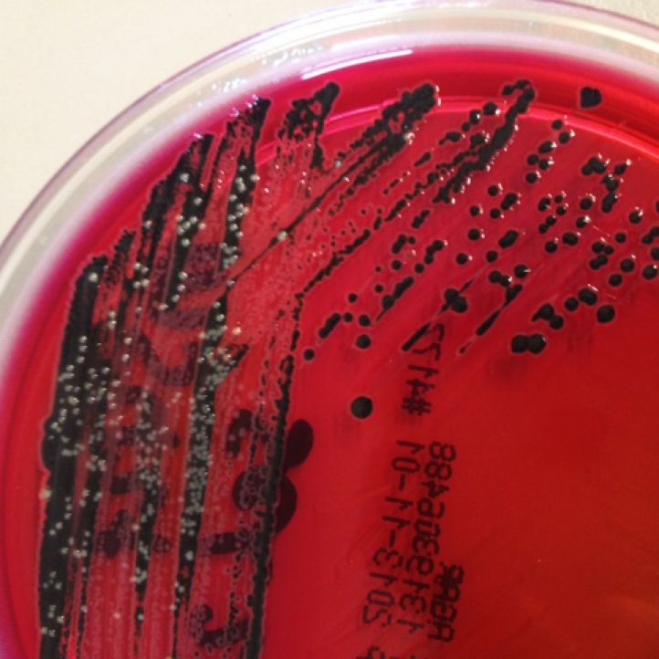 Salmonella spp.